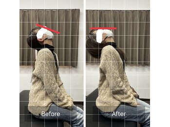 ナオル整体 平塚院(NAORU整体)/猫背矯正で首の可動域UP!!