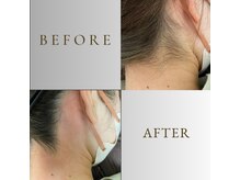 ルナソルビューティーサロン 浜松店(Lunasol)/大人気♪うなじ MIX脱毛