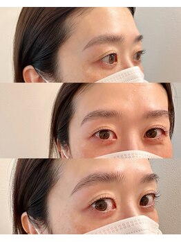 マルレ アイサロン 三軒茶屋(MARLE eyesalon)/Set menu ★