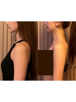 アロマで癒されたい