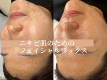 ハナワクシングプラス 高知(HanaWaxing+)の雰囲気（フェイシャルワックス/ニキビ/ブラジリアンワックス/VIO脱毛）