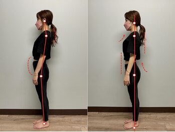 ワクワクボディ 横浜店(WAKUWAKU BODY)の写真/【姿勢から変わる、“韓国女優体型”へ】マシンピラティス×整体でしなやかに引き締め◎