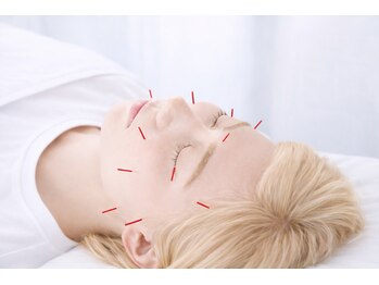 グレース鍼灸院 整骨院 ひたちなかの写真/【エリア希少◇美容も不調改善も同時に叶えられる鍼灸院】国家資格保有の鍼灸師在籍◎ピンポイントで改善◎