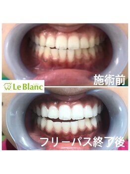 ルブラン 奈良店(Le Blanc)/回数券通いのお客様!!