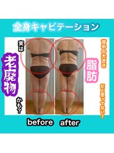 ビューティ ウィッチ(Beauty Witch)/