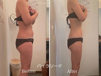 ヘアーアンドエステティック ヴェリス(hair&esthetic Velis)/ゴールが見えるパイラソード痩身