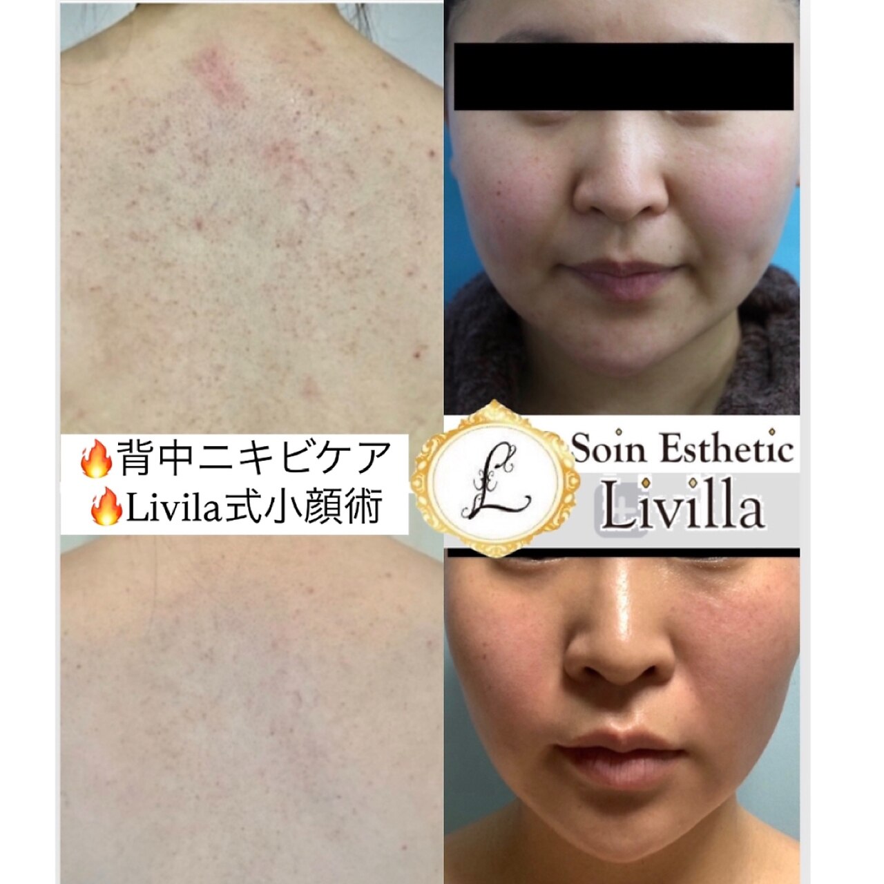 ソワン エステティック リヴィラ(Soin Esthetic Livilla