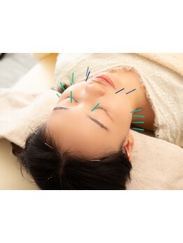 鍼灸施術を受けたい