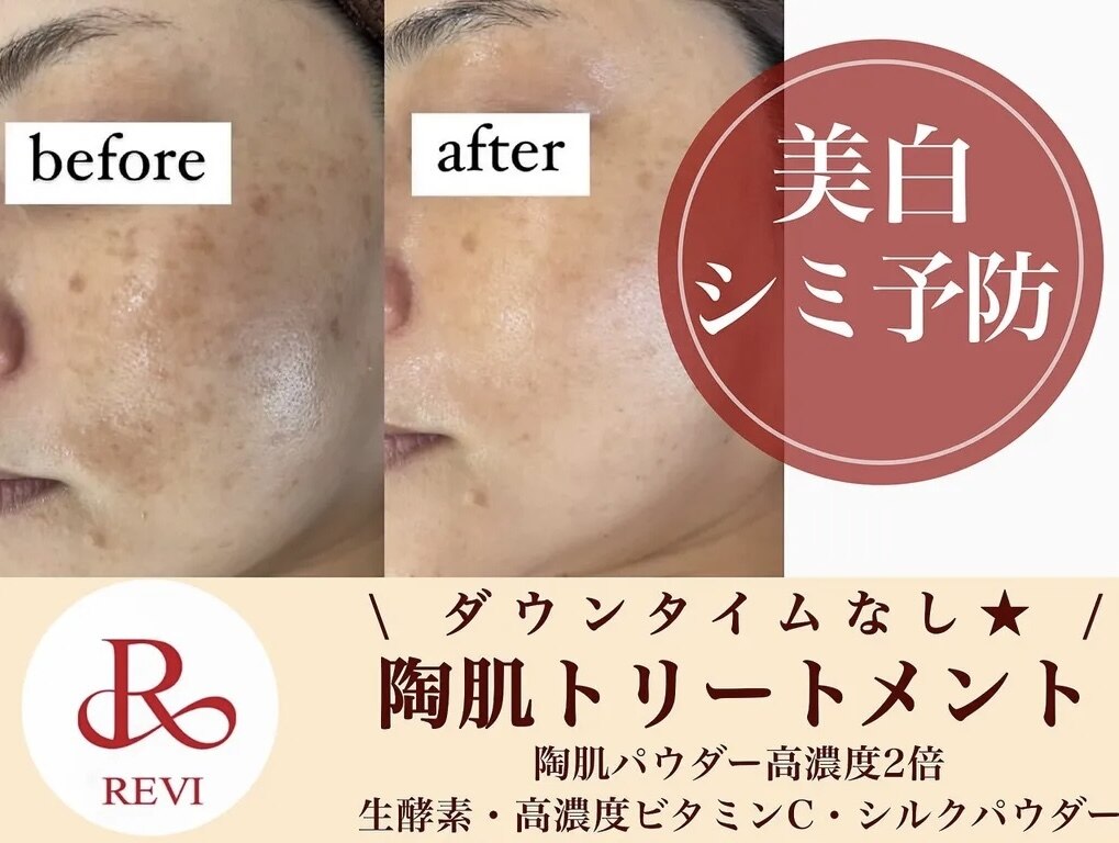 川崎市幸区でピーリングが人気のエステサロン｜ホットペッパー