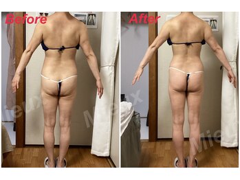 ミュー 新小岩店(Mieux)/Wマシン+発汗130分