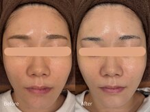 アウラ 小杉店(AULA)/ララピール☆