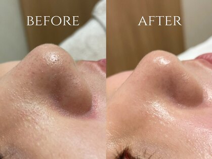 サロンヴィヴィ 大阪心斎橋店(salon ViVi)の写真