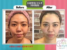 小顔整体研究所 【KSラボ】 錦糸町店の雰囲気(お客様から伝えなくても伝わる魔法のカルテでリピート率90%以上)