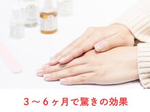 広島深爪専門ネイルサロン　ナッカ/