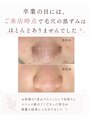 メモリ 毛穴の黒ずみをただ取るだけでなく、悩みを繰り返さない肌作りへ