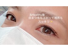 ミュー(mieux)/&Healthy☆