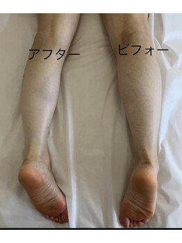 ビ フェイス(Bi-face)/下半身リンパマッサージ