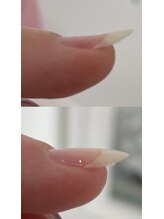 アンベリール(Embellir)/そり爪さん