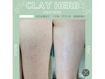 スリジエ ボーテ(cerisierBEAUTE)/ヒップ/フット/足の美白ケア☆