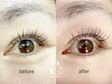 ムニ(muni)/&healthy【アンドヘルシー】