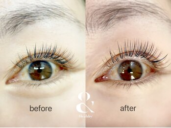 ムニ(muni)/&healthy【アンドヘルシー】