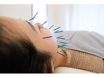 ハリカ 神戸三宮(harica)/美容鍼