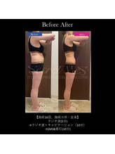 フェレザ 新潟(Felleza)/気になるお腹を徹底ケア