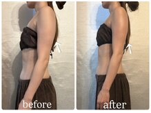 ビノスビューティー(vinos.beauty)/症例写真　上半身痩身