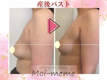 モワメーム(Moi-meme)/下着なしでも変化◎