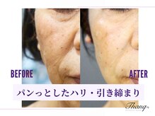 サンク(Thanq)/60代のエイジングケアにも大好評