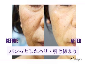 サンク(Thanq)/60代のエイジングケアにも大好評