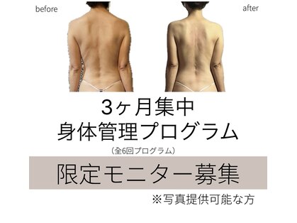 トイ(Toi)の写真