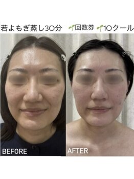 ミミルーチェ 中目黒(mimiluce)/蒸しただけで透明感あるお肌へ