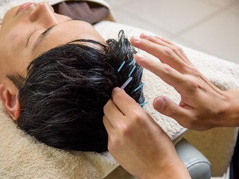 ハリキー(鍼×KEY)/