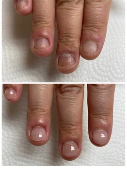 ココ ネイル サロン アンドスクール(COCO.NAIL SALON&SCHOOL)/爪噛み改善スカルプ