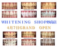 ホワイトニングショップ 妙高店(whiteningshop)