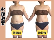 ミロク178式プロデュース(MIROKU178式プロデュース)/1回の施術で変化！！