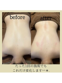 介正鍼灸整骨院 整体院 エフコープ大野城店/アロマリンパのビフォーアフター