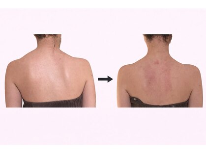 ソバニ(SOBANI)の写真