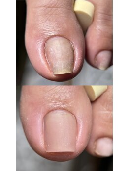 【リペアメニュー】ビフォアフ