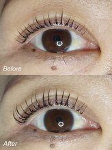 エーラッシュ(A-Lash)/いく毛3ヵ月ビフォー＆アフター