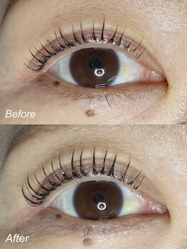 エーラッシュ(A-Lash)/いく毛3ヵ月ビフォー&アフター
