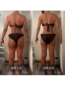 フィエルテ 甲斐敷島(FIERTE)/Before after