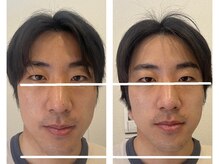 ナチュラルセラピー ドロップ(Drop)/美容整体２回目の変化