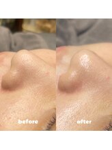 プティジョナ(Petit Jona)/★ハイドロスプラッシュ★