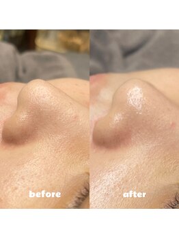 プティジョナ(Petit Jona)/★ハイドロスプラッシュ★