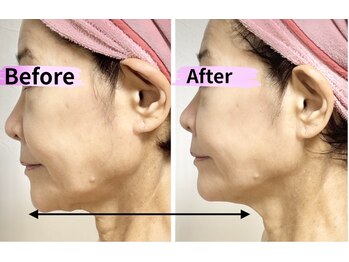 マリア(MALIA)/50代60代たるみ改善南森町