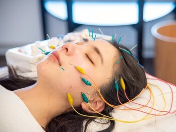 しらゆき堂鍼治療院の写真/【エイジングケアに大人気★】美容鍼でコラーゲン・エラスチンの生成を促進して、つるつるハリツヤ肌へ！