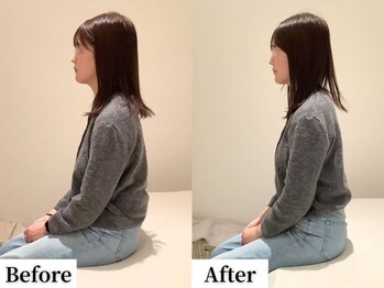 ソレア(Solea)/姿勢改善1回目 Before/After