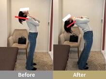 せなかのはね 井尻店/30代　猫背　肩こり　背中の張り